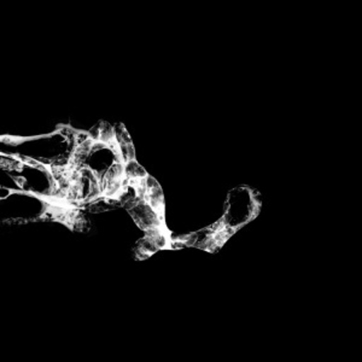 Saffronkeira – Tourette