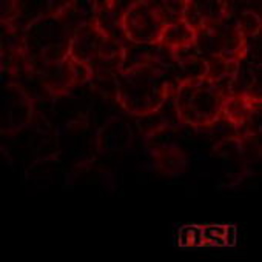 O.S.I. – Blood