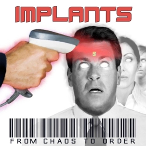 Implants – From Chaos To Order