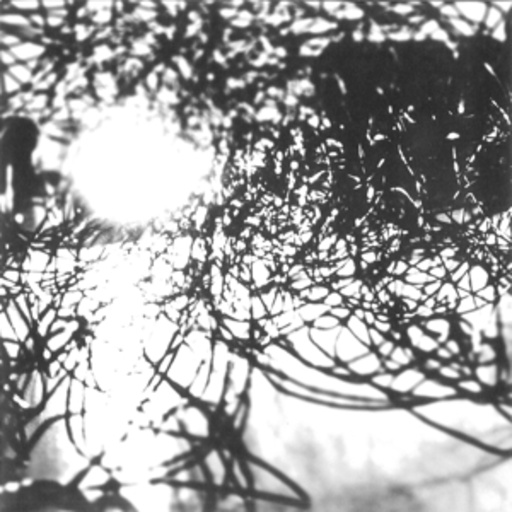 Thisquietarmy/Syndrome – Muhka