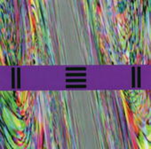 Front 242 – Still & Raw EP