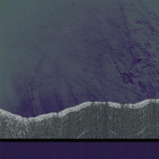 Lumisokea – Apophenia