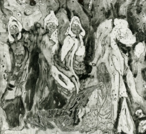 Dire Omen – Wresting The Revelation Of Futility