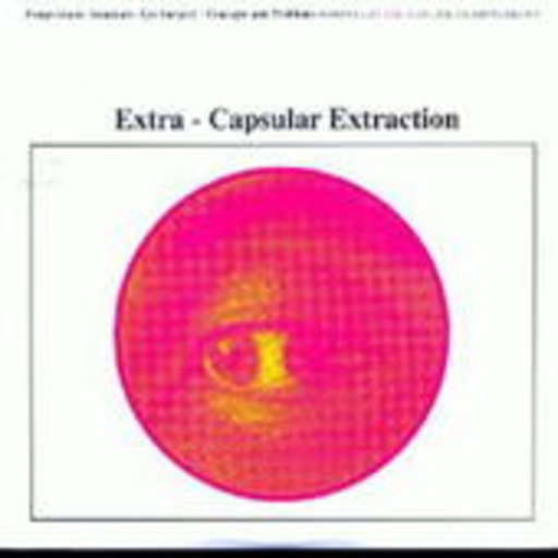 Earth – Extra - Capsular Extraction