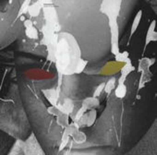 Motorpsycho – Child Of The Future