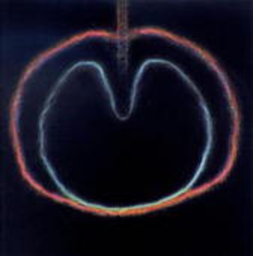 XTC – Wasp Star - Apple Venus Vol. 2