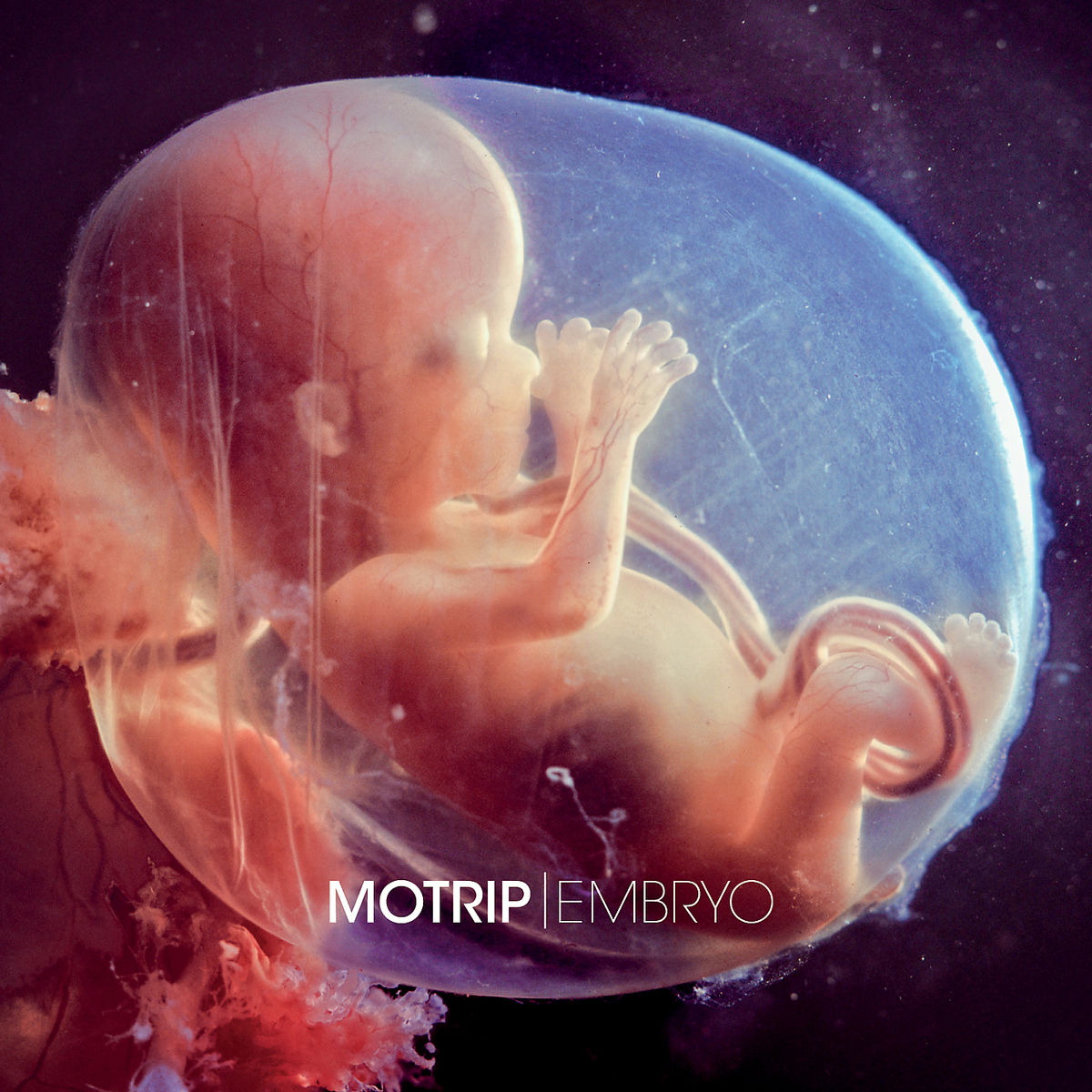 MoTrip – Embryo